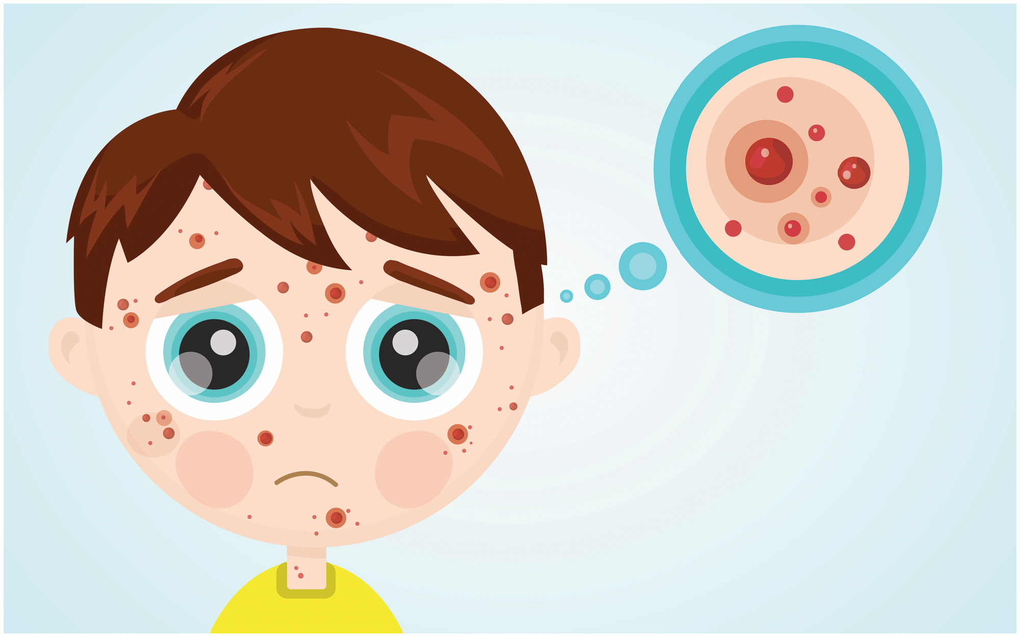 Measles, Rubella, Chickenpox…OH MY!